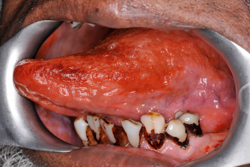 red blemished tongue with rotten teeth