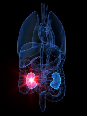X-ray with 1 kidney highlighted in red light